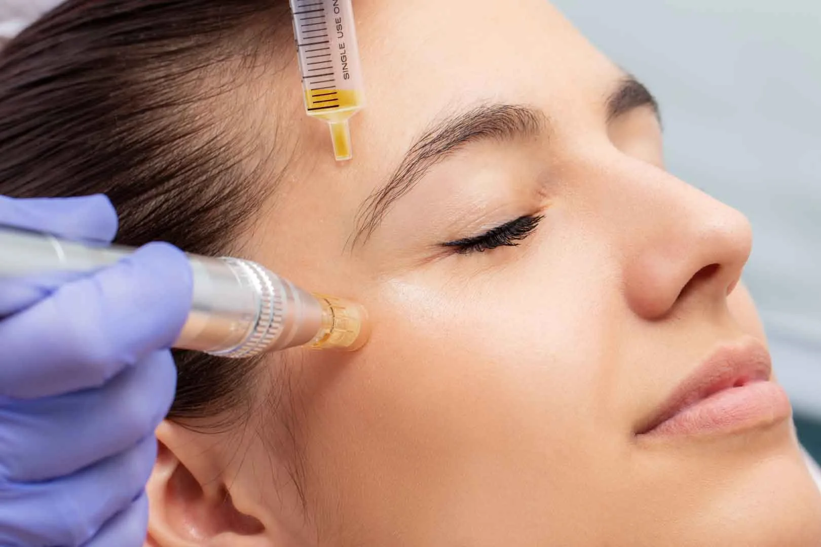 Mesotherapy clinic, Mesotherapy clinic in Pune, Mesotherapy clinic in Kharadi, Mesotherapy treatment in Kharadi, Mesotherapy treatment in pune, Mesotherapy treatment