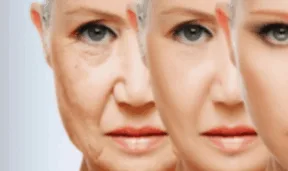 Skin Rejuvenation